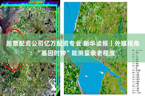 股票配资公司亿万配资专业 新华读报|外媒视角:“基因时钟”能测量衰老程度